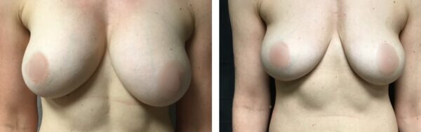 dd60b526 e55a 4f7d a441 c939772686a5