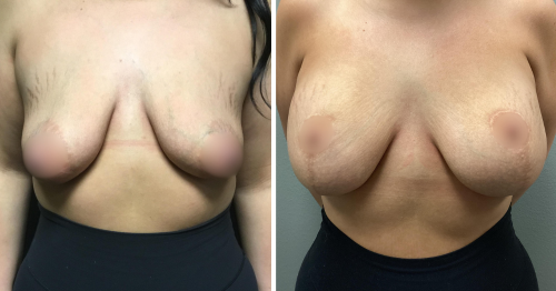 Untitled design (10)