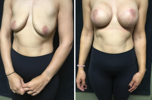 Untitled design (11)