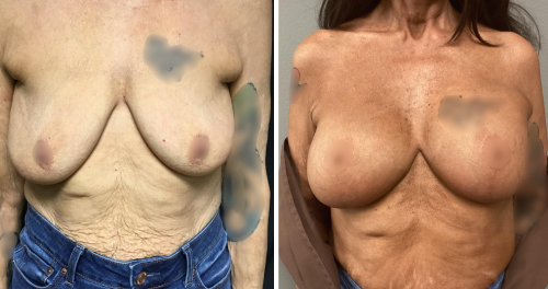 Untitled design (13)