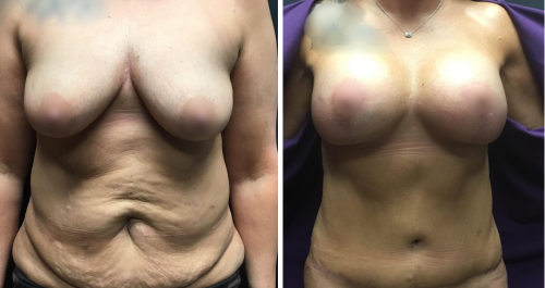 Untitled design (14)