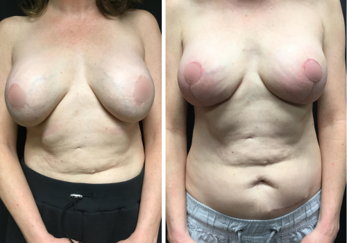 Untitled design (24)