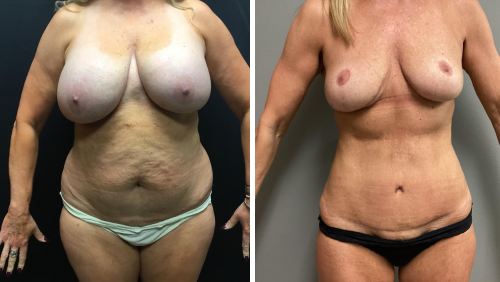 Untitled design (16)