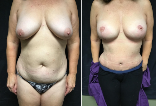 Untitled design (32)