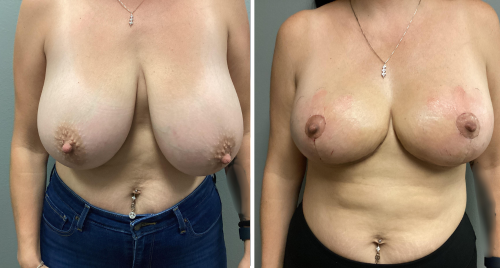 Untitled design (37)