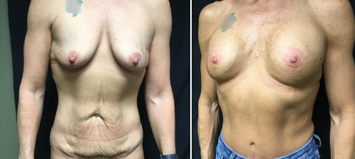 Untitled design (44)