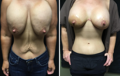 Untitled design (46)