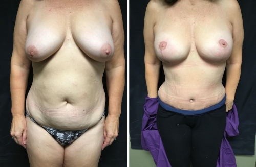 Untitled design (47)