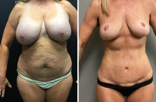 Untitled design (48)