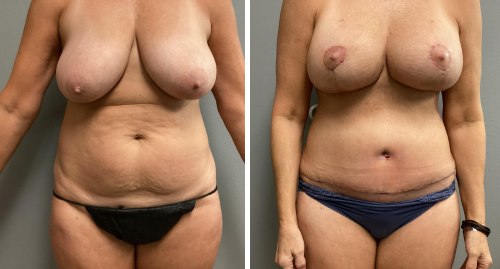 Untitled design (57)